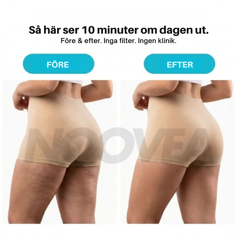 Noovea  Den nya massage­rollen mot celluliter v1